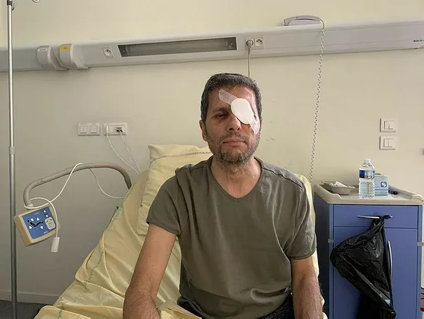 Paris'te gözünden yaralanan AA Foto Muhabiri Mustafa Yalçın, yaşadıklarını anlattı-1