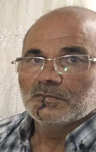 İstanbul Pendik’te öfkeli damat, kayınpederinin dudağını ısırdı!