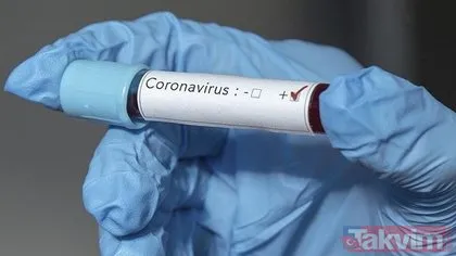 Corona virüsten hayatını kaybeden ünlüler şoke etti! Onlar koronavirüs mücadelesini kaybetti!