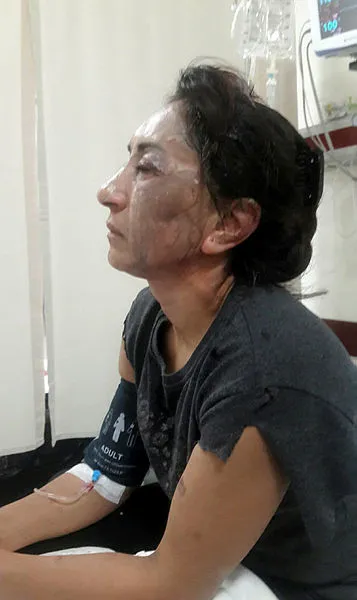 Isparta'da cani adam kendisinden boşanmak isteyen eşine kezzapla saldırdı!-4