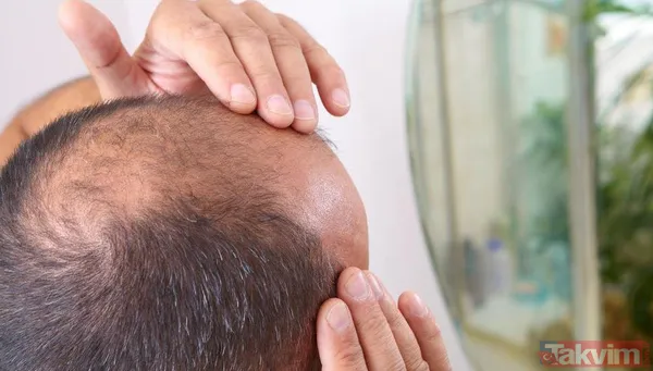 Kelliği tarihe gömüyor yapan göz alıcı sırma saçlara sahip oluyor! Saç ektirme işlemine servet dökmeden bu işi çözün - 2