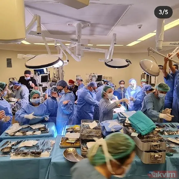 İstanbul'da tarihi ameliyat! Bir yaşını doldurmayan siyam ikizi 9 saat süren operasyonla ayrıldı - 11