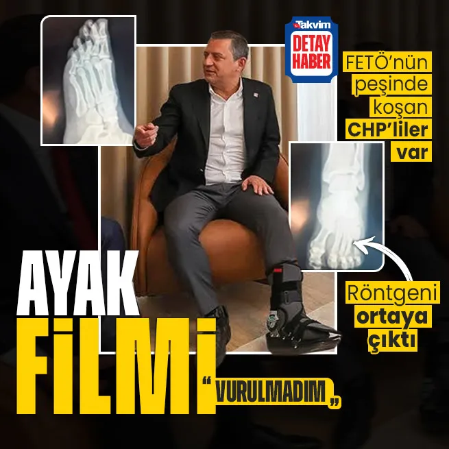 Özgür Özelin ayak bilmecesi! Vuruldu dediler neler yaşandığını anlattı... Röntgeni ortaya çıktı