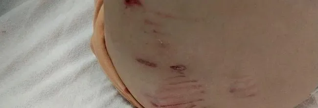 ankarada-basibos-kopekler-bu-kez-5-yasindaki-cocu-1724424404137.jpeg Bir başıboş köpek vakası da Ankara Gölbaşı'nda: 5 yaşındaki çocuğu sürükleyip yaraladı-2