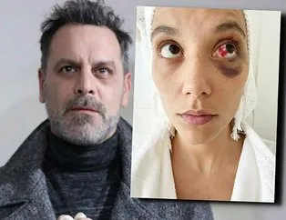 Dayakçı Ozan’ın davasına bakanlık müdahil oldu