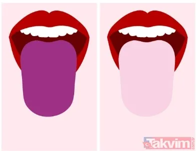 🔴 Kırmızı Veya Beyaz Lekeler Ağız Kanseri Riskine İşaret Edebilecek Bu Lekeler Mutlaka Ciddiye Alınmalı. Kırmızı Alanlar: Erytroplaki Belirtisi Olabilir. Beyaz...