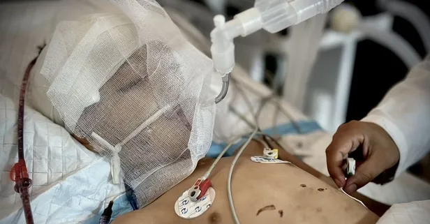 Allah'ın mucizesiydi: Nusayrat Kampı'nda öldü sanılıp kefene sarılacaktı | 5 yaşındaki Ebu Tevfik yoğun bakımda can verdi