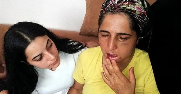 22 yıldır eşinden şiddet görüyor!