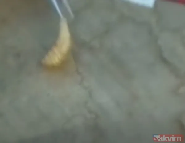 Karnındaki şişlik için gitti içinden çıkan doktorları bile şoke etti! Yer uzak değil Kayseri! 64 kilo girdi 55 kilo çıktı - 46