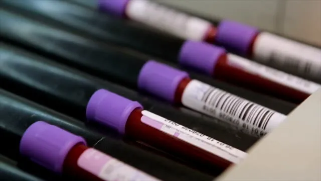 Bu kan grubundakiler çelik gibi vücuda sahip! En şanssız kan grubu belli oldu! Bu kişilerin kanser olma riski...-6