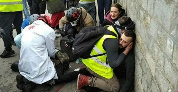 Paris’teki gösterilerde bir göstericinin kolu koptu!