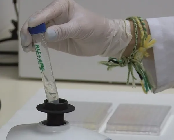 Son dakika: Türkiye'de ilk! Dünyanın merakla beklediği koronavirüs aşısı insanlarda denenecek!-8