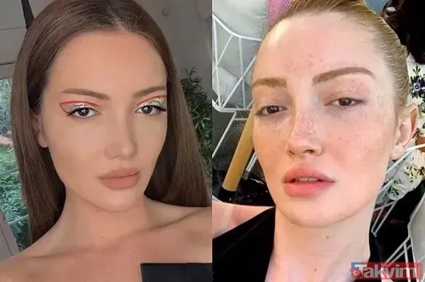 'Hehe' diyerek paylaştı son pozunu gören gözlerine inanamadı! Yıldız Tilbe'nin dişine ne oldu? 57 yaşındaki Yıldız Tilbe... - 31