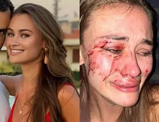 Daria Kyryliuk’un darp iddiasında sürpriz tanık