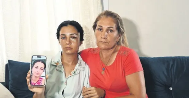 Eski eşi tarafından darbedildi!