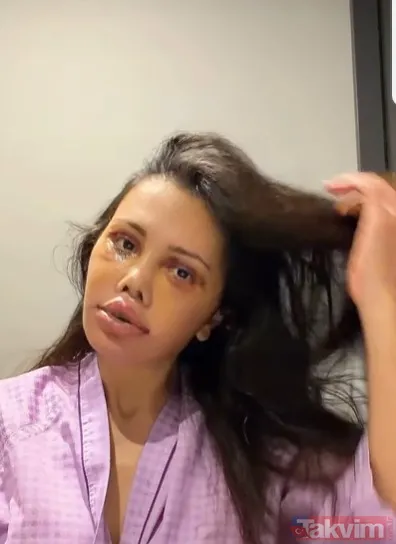 Eski Survivor yarışmacısı Didem Ceran Güney Kore'de 15 saatlik "yüz nakli" operasyonu geçirdi - 1