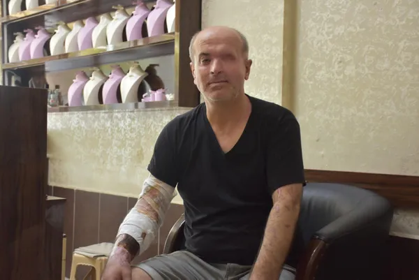 izmir-bucada-30-yillik-kuyumcu-kezzpli-saldiri-sonucu-sol-gozunu-kaybetti-1631280884840.jpg İzmir Buca'da 30 yıllık kuyumcu kezzaplı saldırı sonucu sol gözünü kaybetti-2