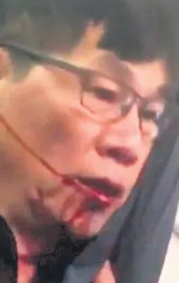 Para yaralarını sardı!