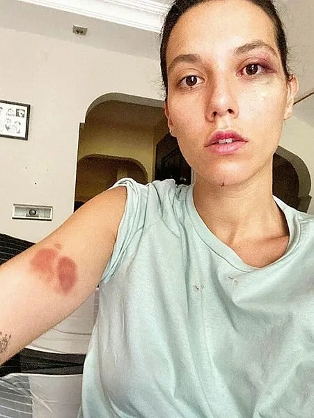 Deniz Bulutsuz'a şiddet uygulayan Ozan Güven hakim karşısına çıkıyor! 13.5 yıla kadar hapsi isteniyordu...-3