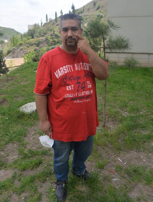 gozune-kacan-metal-parcayi-3-yil-sonra-miknatisla-tespit-etti-operasyonla-alindi-1620386598928.jpg Gözüne kaçan metal parçayı 3 yıl sonra mıknatısla tespit etti! Operasyonla alındı-5