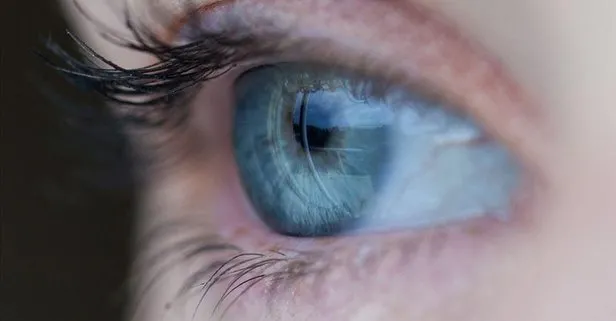 Glokom, göz tansiyonunun yükselmesiyle ortaya çıkıyor Sağlık haberleri