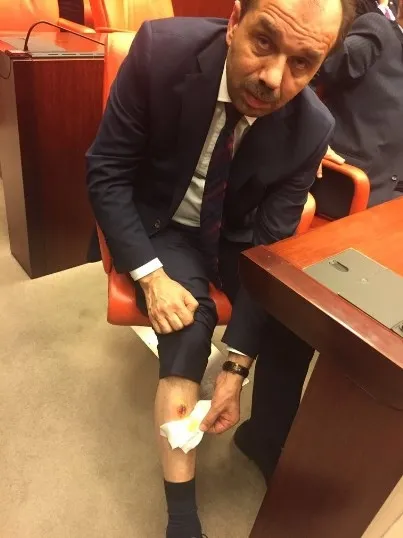 CHP'li vekil AK Partili Balta'nın bacağını ısırdı-2