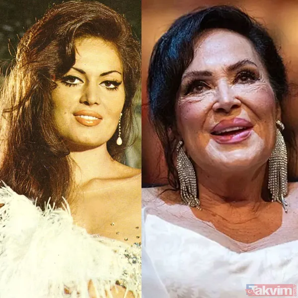 Yeşilçam'ın en güzellerindendi! 70 yaşındaki Gülşen Bubikoğlu son haliyle hayrete düşürdü! - 18