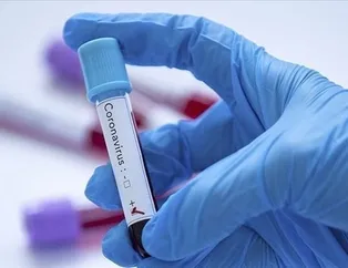 E devlet ile Covid 19 test sonucu öğrenme ekranı!