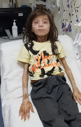 Bursa'da Cem Muhammet'i çöp eve kilitleyen teyze hakkında istenen ceza belli oldu