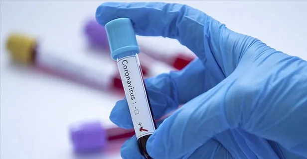 Koronavirüste bağışıklık sisteminizi bu 8 hata etkileyebilir