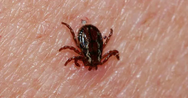 Dikkat! Bu hata öldürür! Kene ısırırsa sakın bunu yapmayın