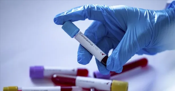 BTP Genel Başkanı Haydar Baş ve ailesinde koronavirüs şoku! Yoğun bakıma alındı