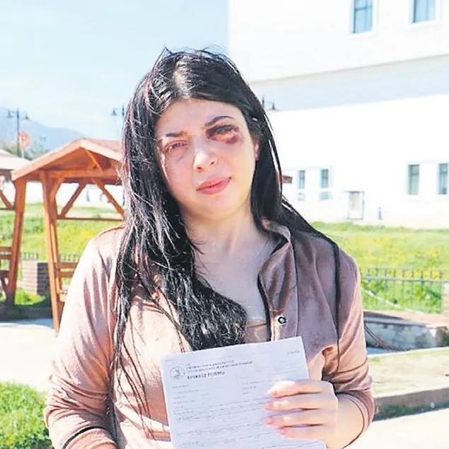 3 ay sıvı ile besleneceğim