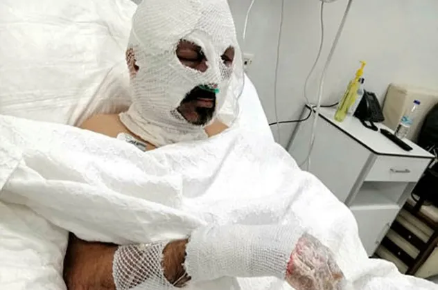 Zonguldak'ta kan donduran vahşet! Tiner döküp diri diri yaktı