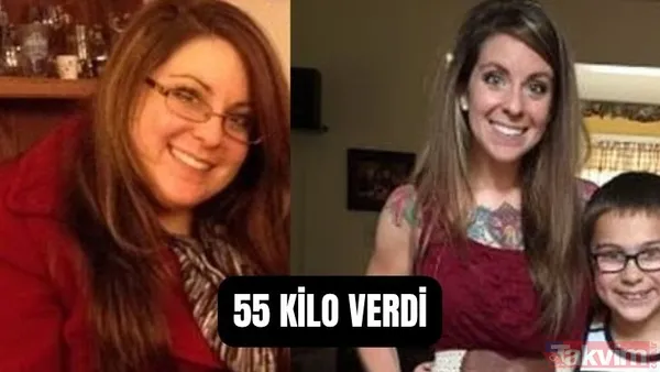 Hastası Uyardı! Obez Doktor Kendi Tavsiyesiyle 55 Kilo Verdi - 1