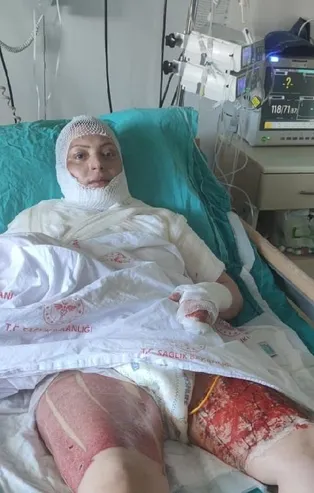 Eski eşi Elvan Sözkesen'i yanıcı maddeyle ateşe verip yanarken izledi!