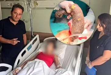 Midesinden çıkanlar doktoru bile şaşırttı