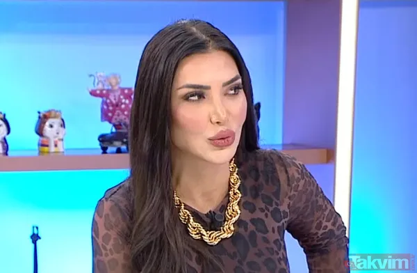 Çizgili gömlek bilmecesi çözüldü! Hadise paylaşmış ortalık karışmıştı! Ne Mehmet Dinçerler ne de Berk Atan meğer o isim... - 11