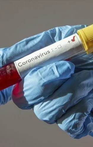 Burkina Faso'da 5 bakan koronavirüse (Kovid-19) yakalandı