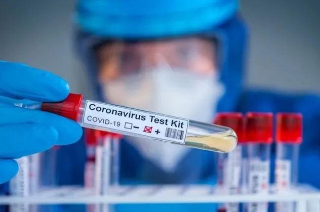 Covid-19 test sonucu ne zaman çıkar? PCR test sonucu kaç günde çıkar? E-Nabız koronavirüs test sonucu sorgulama ekranı!