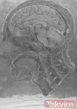 İnsanlığın Kara Lekesi: Toplama Kamplarındaki Korkunç Nazi Tıbbi Deneyleri