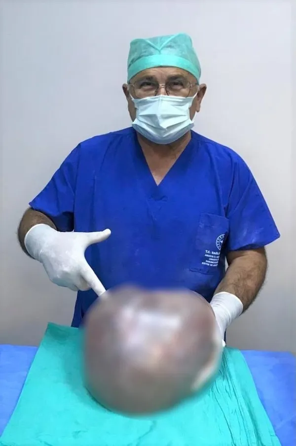 amasyada-hamile-oldugunu-dusunen-kadinin-karnindan-65-kilogram-kitle-cikti-1623910473449.jpg Amasya'da hamile olduğunu düşünen kadının karnından 6,5 kilogram kitle çıktı-5