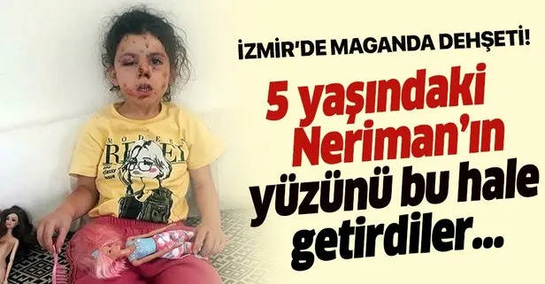 İzmir’de maganda dehşeti! 5 yaşındaki Neriman’ı bu hale getirdiler