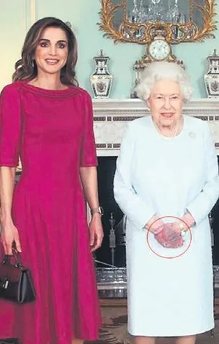 Kraliçe Elizabeth’in elindeki morluk endişelendirdi