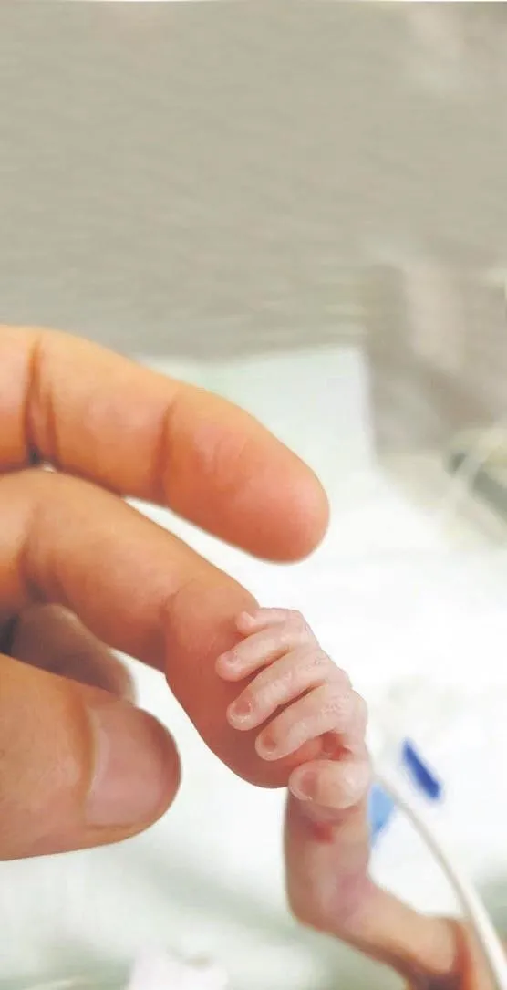 Sidar bebek 175 günlükken doğdu 207 günde hayata tutundu!