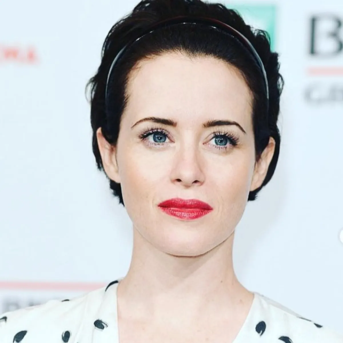 Claire Foy’un hayatını karartan tatil: 5 yıldır bu parazitle mücadele ediyor