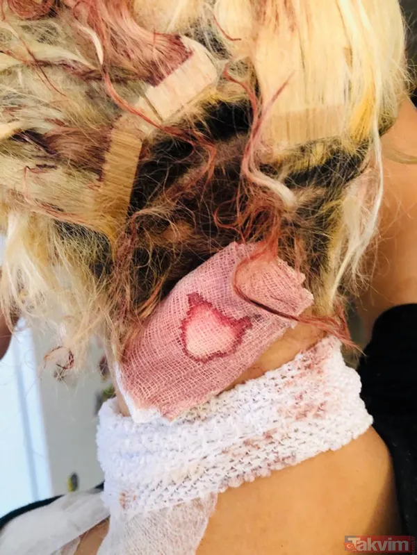 Erkek arkadaşı ensesinden vurdu! Genç kadının ilk duruşma öncesi yardım çığlığı - 6