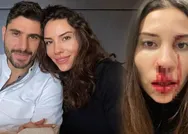 Özer Hurmacı ile eşi Mihriban Hurmacının şiddet krizi büyüyor! Yüzü gözü kan içinde kalmıştı Özerden cevap geldi o beni ısırdı