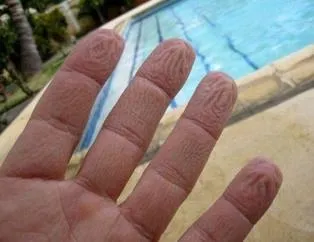 Parmaklar suda neden buruşur? İşte mucizenin cevabı