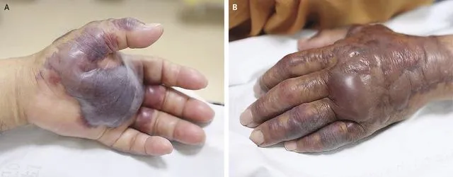  Deniz ürünlerine dikkat! Çiğ yedi elinden oldu!  - 2